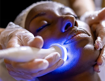 Laser Treatments Banner